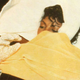Michael Jackson after scorching his hair during a Pepsi commercial shoot (via michaeljacksonrememberedwithlove.com)